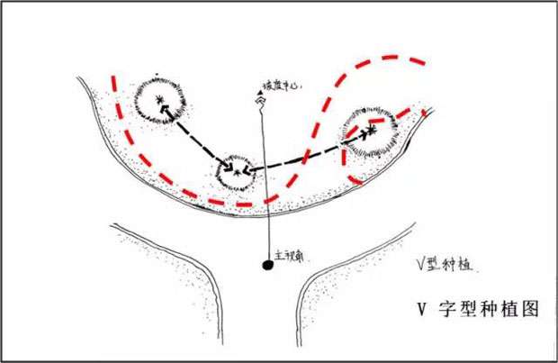 V字型种植图.jpg