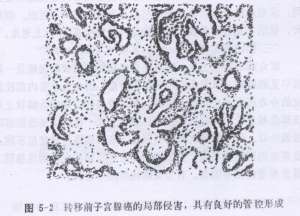 兔子宫腺癌病的症状、诊断和防冶方法【库百科养殖网】