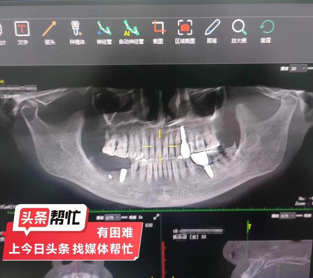 晨意帮忙丨牙没种完就关店，老人半边脸麻了1年！泰康拜博口腔：她闹事影响经营