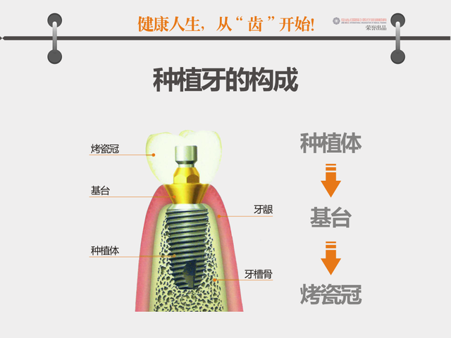 口腔科增设口腔种植专科门诊 助您笑口常开