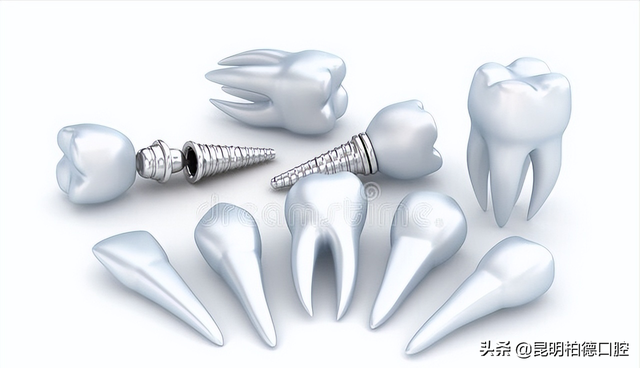 「牙齿那些事儿」No.167丨种植牙掉了还能再种吗？
