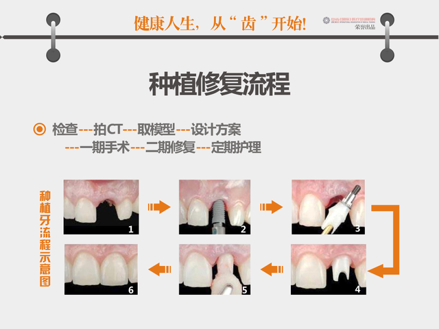 口腔科增设口腔种植专科门诊 助您笑口常开