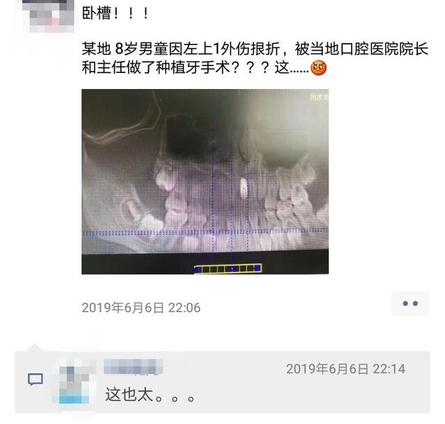 给8岁儿童种牙，这个案例为何被称为口腔界的耻辱？