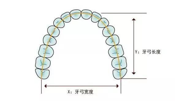 正畸治疗中专业名词解析，临床中讲对了几个？