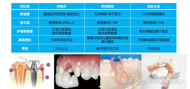 种牙花15000，保险报了9000，好爽