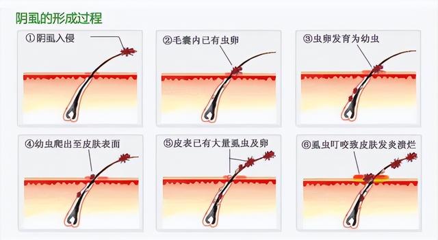 为什么有人“下面”没毛？关于私处毛发的秘密，这些你都知道吗？