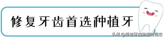 在北京做种植牙去哪儿种最靠谱？