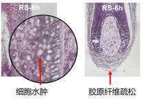 植发人群最关注什么？74%人群焦虑毛发移植存活率问题