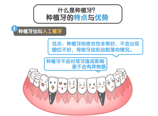 年轻人缺牙是选镶牙还是种植牙？年轻人植牙选择什么植体好？