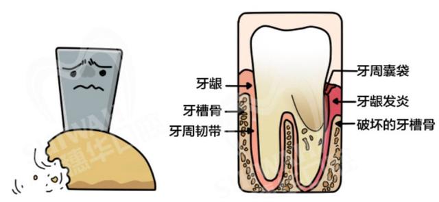 高龄老人能不能种牙？种牙前，还需要注意哪些事情？