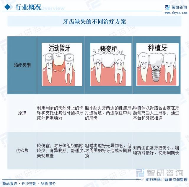 【前景趋势】一文读懂2023年人工种植牙种植体行业未来发展前景