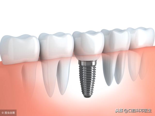 种植牙也有4大天敌，你是天敌吗？