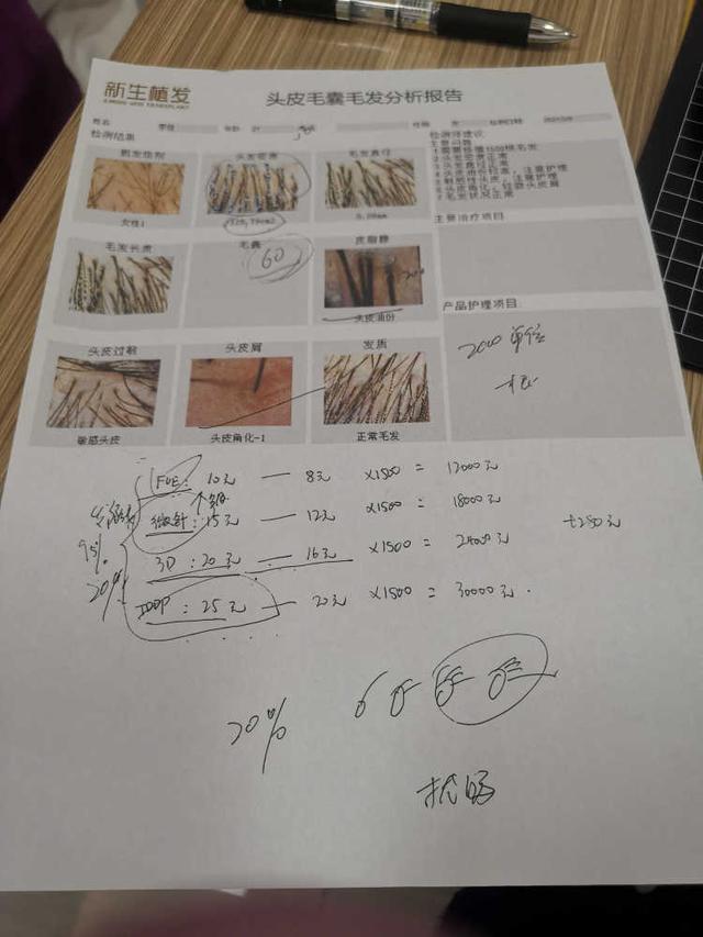 0.1元植发为何变成2.8万？“新生植发”为发量正常记者设计植发2000单位