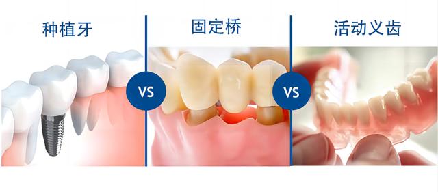 牙齿松动怎么办？一定要拔吗？