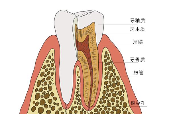 种植牙一颗就要上万？种牙为啥这么贵，难道又是暴利行业？