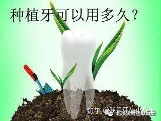 种植牙和烤瓷牙究竟有哪些区别？为什么都说种植牙好？