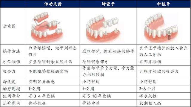 缺牙老人，活动假牙、镶牙、种牙哪种更划算？费用对比来了