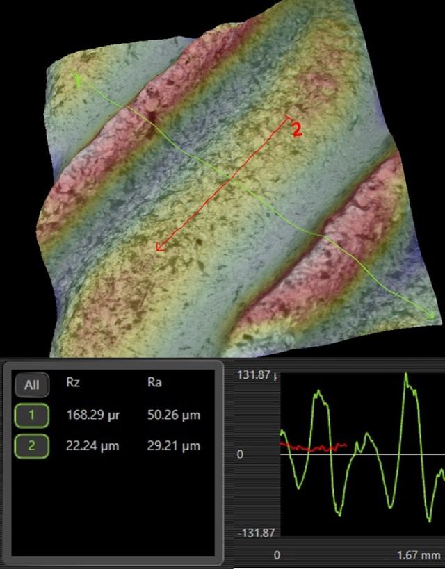 口腔医学科学家们如何不断提高种植牙的成功率与安全性（上篇）