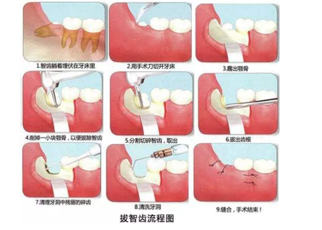 “看完流血不止的牙，我才知道自己患上了白血病。”