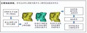 种植牙漏骨粉(上颌窦内提升术最佳二期修复时间的有限元分析)