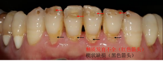 明星都在用的美牙神器，助你快速美出圈！