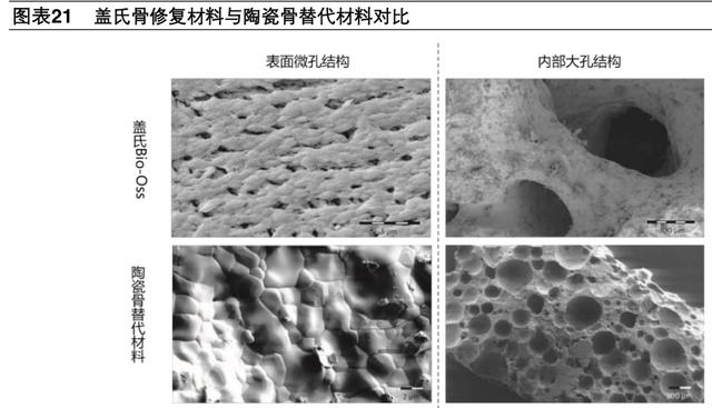 牙科医疗专题报告：种植牙深度研究