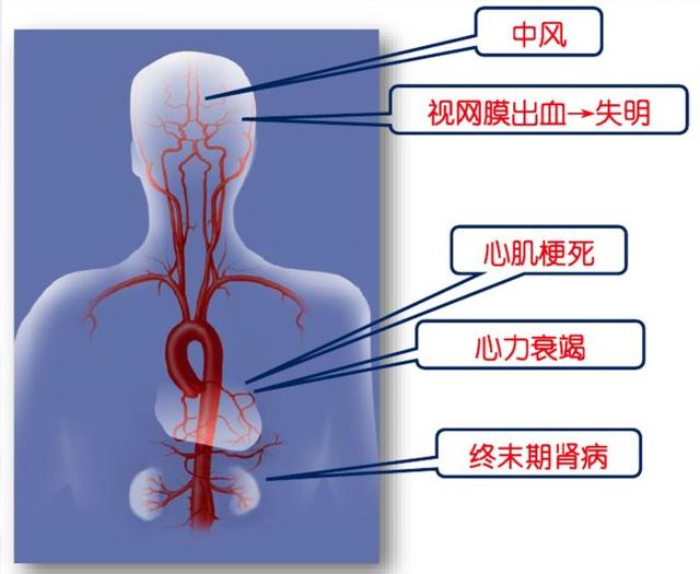 口腔种植后，可不能随便用药