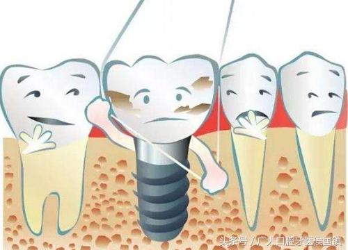 种植牙出现这个现象，说明炎症已形成，再不注意就破坏骨床了