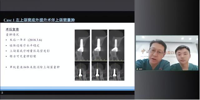 《口腔种植空间维持技术新进展》国家级继教班举行