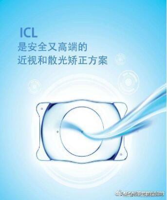 我们说说“高大上”的近视手术——ICL手术的相关问题