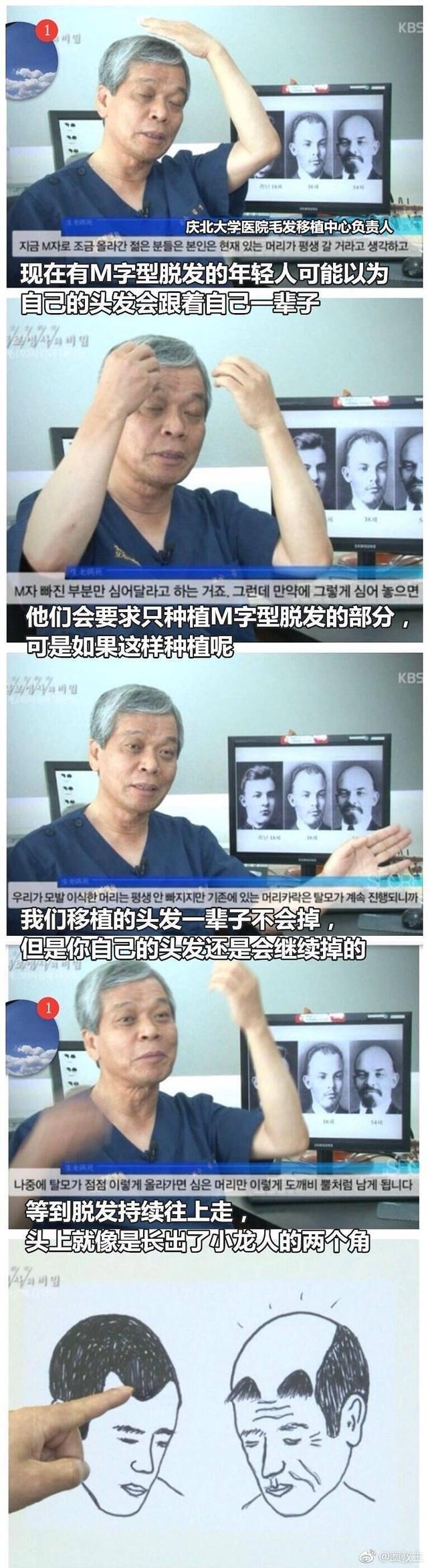 植发需求超整容，如何拯救发际线引发的“颜值危机”？