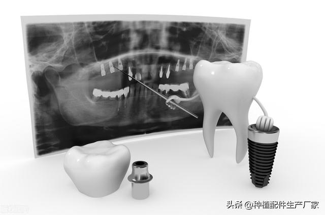 中国种植牙配件市场分析
