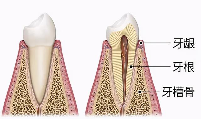 种牙如种树，种树填土，种牙植骨？这个“骨”又是什么？