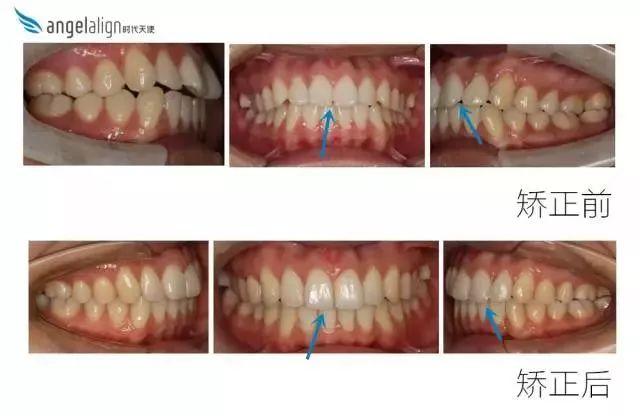 正畸治疗中专业名词解析，临床中讲对了几个？