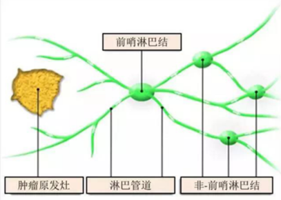 肿瘤没有脚，为什么会跑？