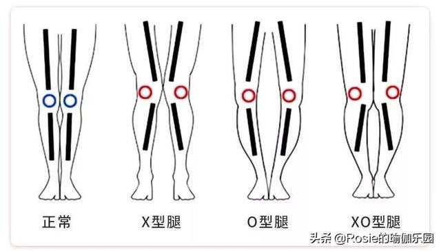 35岁离婚，48岁逆袭第一腿精，腿粗壮肿如何瘦出纤直漫画腿？