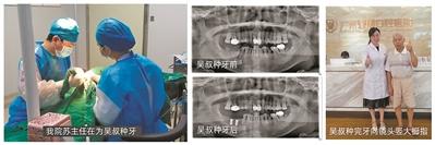 探寻！暨博口腔医院种植牙“长期质保”火爆现象背后