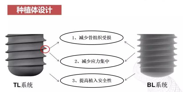 「人工种植牙」国内常见国产口腔种植系统Implants概览（第Ⅱ期）