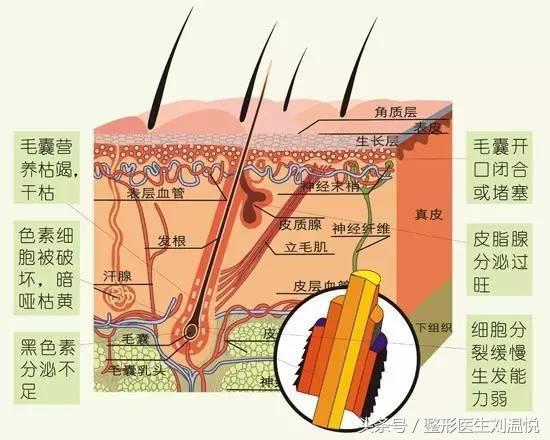 【困扰】地中海和超高发际线？全面毛发移植科普早知道！