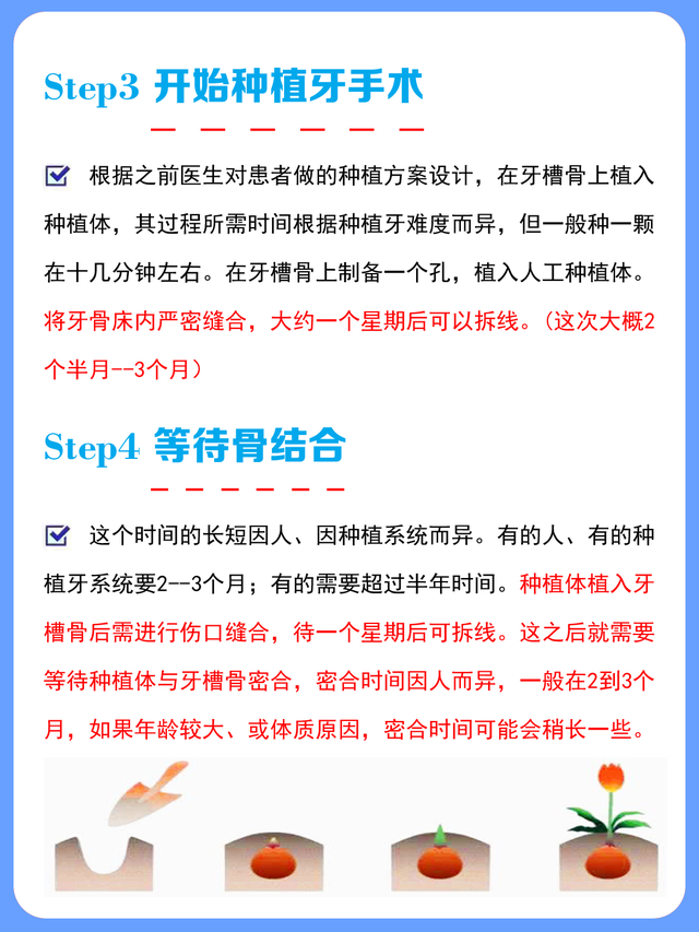 「口腔科普」7个步骤了解种植牙的种植全过程