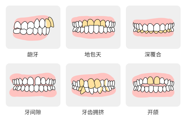 明确！8月新增一笔看牙补贴，帮你省钱！