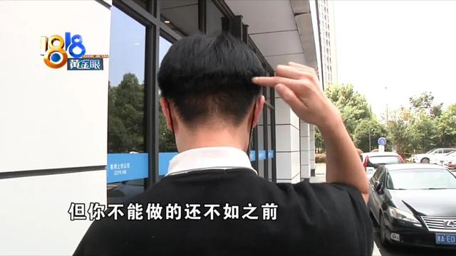 帅气小张“植发”后 左看右看“不如前”