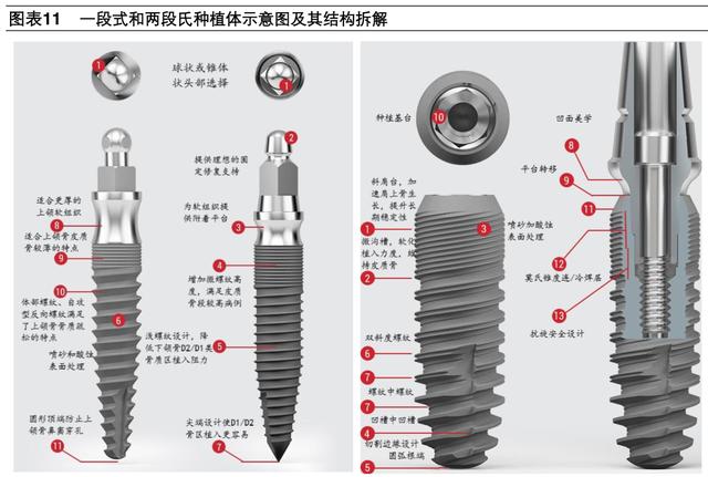 牙科医疗专题报告：种植牙深度研究