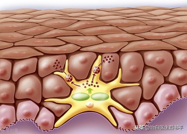 表皮黑色素细胞移植术详解，一分钟看懂那些医生不曾告诉你的真相