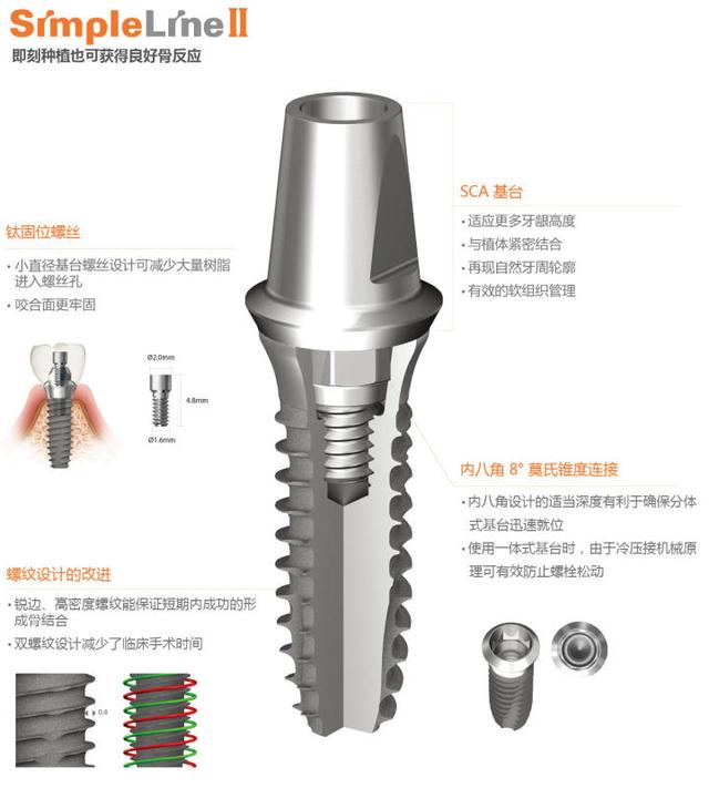 同是种植牙，为什么登腾种植牙那么便宜？因为它种植效果不好吗？