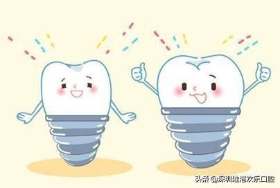 以色列丹特因（DENTIN）种植体好吗？