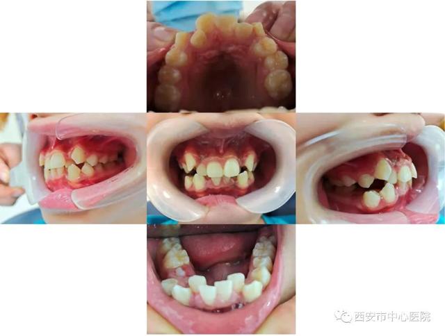 【糖坊街院区科室技术推荐】口腔科