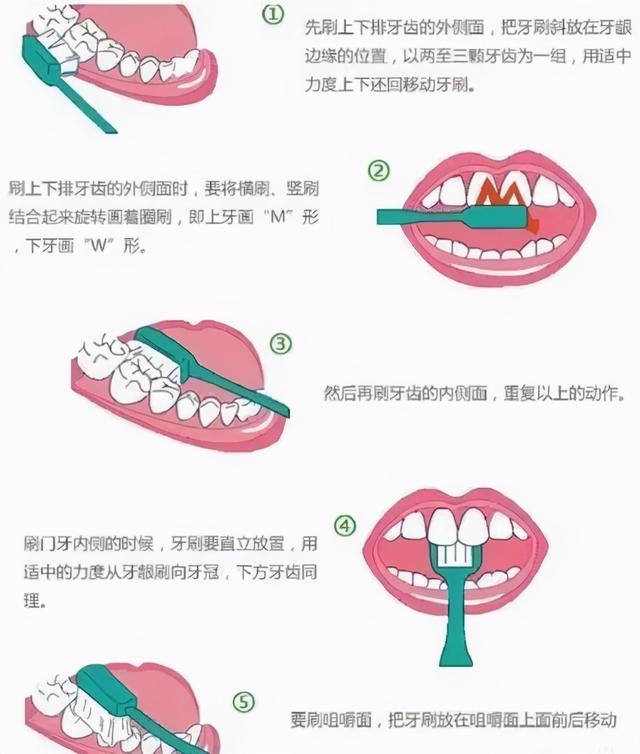 一起来看看种植牙流程是什么样的吧！#雅悦齿科#