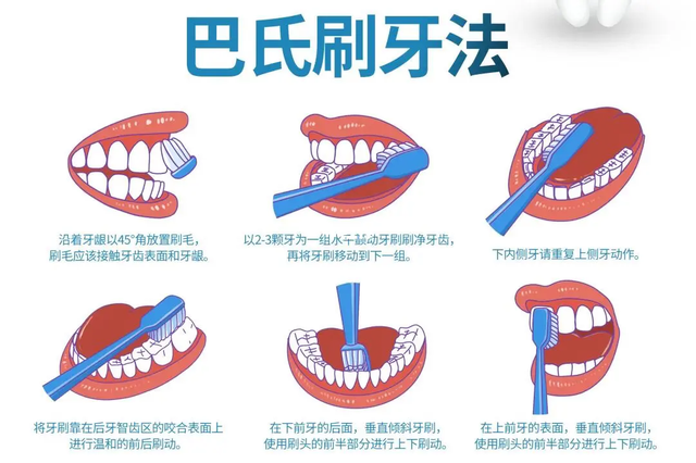 种植牙是假牙，还会蛀牙和发炎吗？