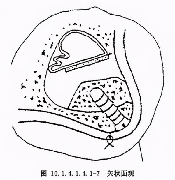 庄龙飞：什么是上颌窦提升术？上颌窦提升术的流程步骤是怎样的？